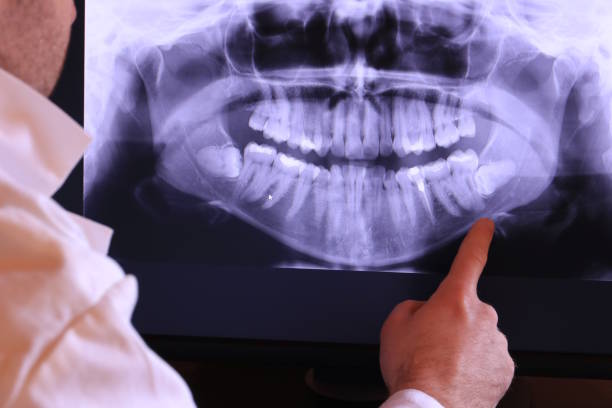 Best Emergency Dental Care for Sports Injuries in Gorevle, IL