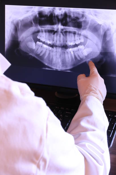 Best Broken or Chipped Tooth Repair in Gorevle, IL