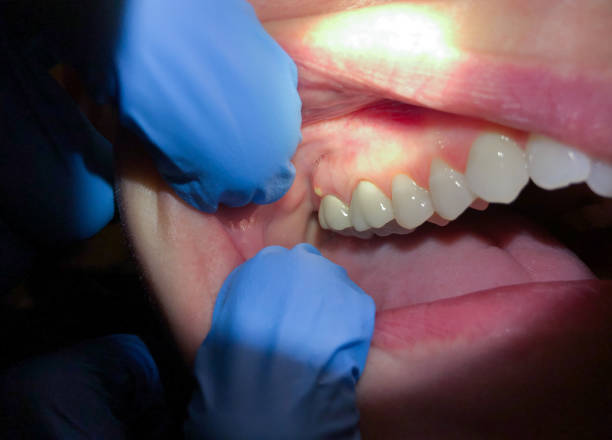 Best Walk-In Emergency Dental Services in Gorevle, IL